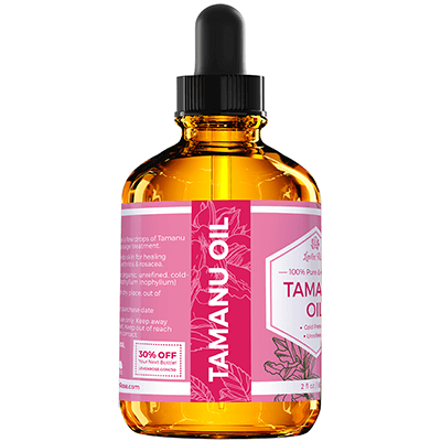 Unlock the extraordinary benefits of Tamanu oil for your hair, nails, and  skin! 🌺💫 From reducing acne scars to promoting hair growth, this… |  Instagram